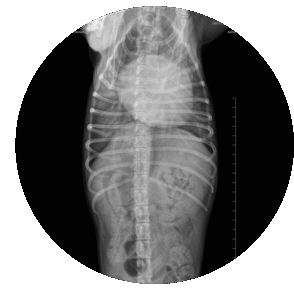 RADIOLOGÍA DIGITAL